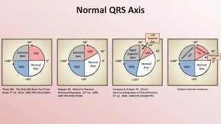 Intro to EKG Interpretation - Rate and Axis