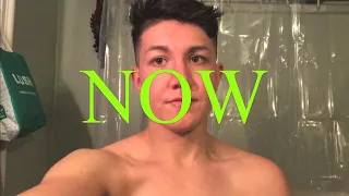 ftm trans - how testosterone has changed my body!