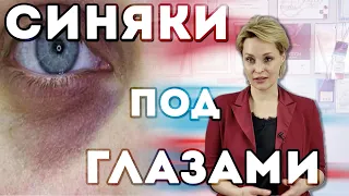 Синяки под глазами из-за ВИТАМИНА Д?