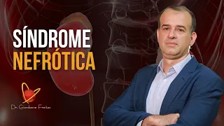 Aula completa sobre Síndrome Nefrótica | Dr. Giordanne Freitas