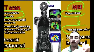 Differences Between X-ray Vs CT scan, and MRI.  Usage and applications