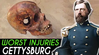 Most HORRIFIC Injuries from The Battle of Gettysburg