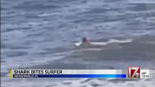 Professional surfer gets bitten by shark