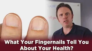 What Your Fingernails Tell You About Your Health?