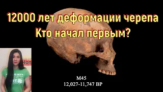 12000 лет деформации черепа. Кто начал первым? [№ CB-016.04.06.2021.]