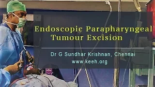 Endoscopic Parapharyngeal Tumour Excision - Dr G Sundhar Krishnan, Chennai