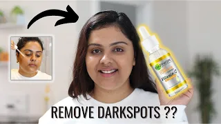 Remove Dark spots with Garnier Vitamin C  Serum | Tanutalks