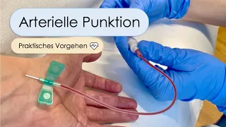 Arterielle Punktion - Schritt für Schritt (Allen Test, arterielle BGA, A.radialis, Tipps und Tricks)