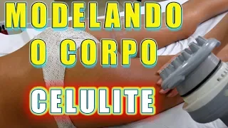 Modele o Corpo - MODELLATA - Protocolo Profissional para Celulite (HLDG)