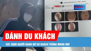 Xác định người đánh nữ du khách thủng màng nhĩ khi đi du lịch tại Ninh Thuận
