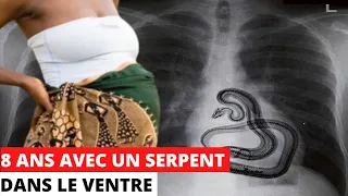 🇬🇦 MA TANTE DE L'ENFER : ELLE A VÉCU 8 ANS AVEC UN SERPENT DANS LE VENTRE