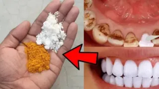 पीले दांतो को सफेद करने का नया तरीका आज तक नहीं देखा होगा / best teeth whitening / how to get white