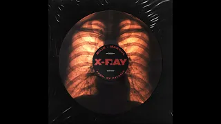 БИЛИК, Markul - X-Ray [Remix. Cuteboy] Slowed+Reverb