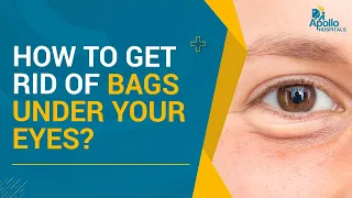 How To Get Rid Of Under Eye Bags? Easily Treatable by a Oculofacial Cosmetic Surgeon