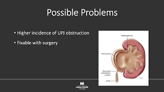 Kidney & Reproductive Implications of Turner Syndrome