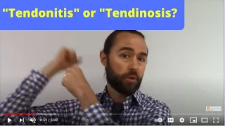 Tendonitis vs. Tendinosis (what they mean and how to treat them)