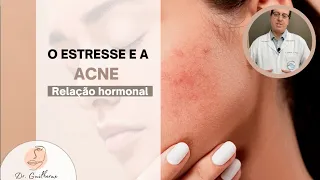 O estresse e a acne - Qual a relação?