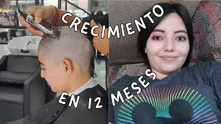 😱 Crecimiento REAL del CABELLO después de una rapada al CERO. @MichelCronicas