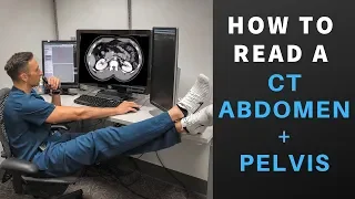 Radiology:  How to Read a CT Abdomen & Pelvis (My search pattern)