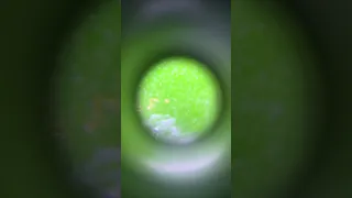 Клещ на орхидее под микроскопом