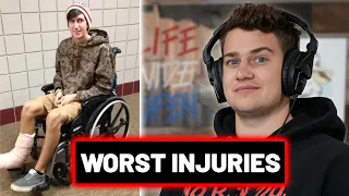 CboysTV's Worst Injuries!! || Life Wide Open Podcast #31