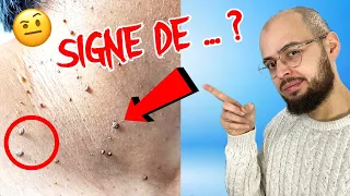 Pourquoi ça sur la peau ?!