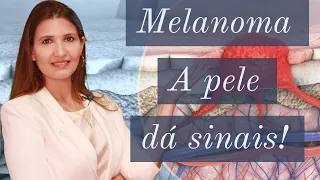 Melanoma - Câncer de Pele | Dra Larissa Montanheiro - Especializada em Dermatologia Oncológica