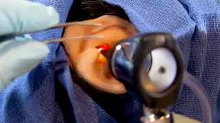 ASMR Removing a Foreign Object from Your Ear | Doctor & Patient POV | Hearing Test