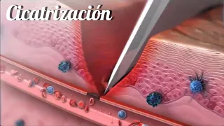 Reparación de tejidos blandos | proceso de cicatrización. #cicatrización