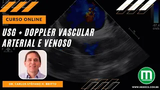 Curso de USG Ultrassonografia Doppler Vascular
