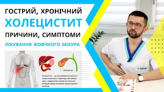 ХОЛЕЦИСТИТ - симптоми, лікування і причини. Гострий та хронічний холецистит