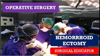 HEMORRHOIDECTOMY/STEP BY STEP  OPERATIVE SURGERY