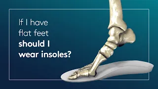 If I have flat feet should I wear insoles?