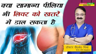 क्या सामान्य पीलिया भी लिवर को खतरे में डाल सकता है ? || WHAT IS LIVER FAILURE