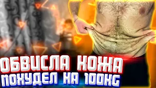 Обвисла Кожа После Похудения На 100кг! // Лишняя Кожа После Диеты // Показываю Результаты