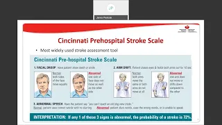 ND Acute Stroke Guideline Overview