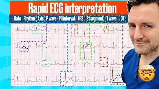 Rapid, structured ECG interpretation: A visual guide FOR REVISION!! #electrocardiogram