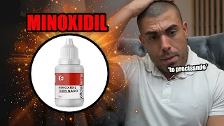 Tudo sobre minoxidil | queda de cabelo, aumento de barba e sobrancelha