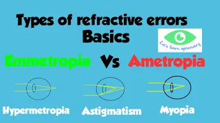 Emmetropia & Ametropia/ Different types of refractive errors/Myopia/ Hypermetropia/Astigmatism