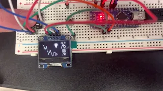 Blood Ox MAX30102 & Arduino Nano with a SSD1306 OLED Display Demo
