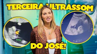TERCEIRA ULTRASSOM DO JOSÉ LEONARDO!!!