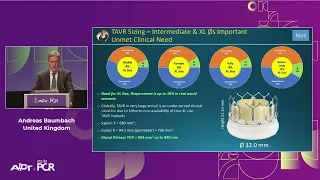 Essentials of lifetime management in patient: TAVI using novel balloon expandable Myval Octacor THV