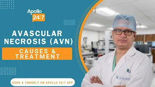 Avascular Necrosis (AVN) Causes & Treatment (In Hindi) | Dr. Amit Kumar Agarwal