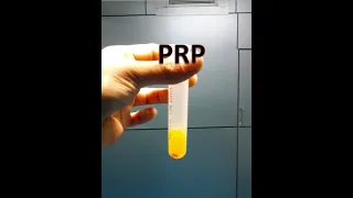 PRP / HOW IT'S MADE