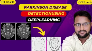 Parkinson Disease Detection Using CNN And Deeplearning | IEEE Machine Learning Projects 2024-25