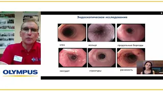 Эозинофильный эзофагит в России. В. О. Кайбышева. Комментарий Пратика Шарма