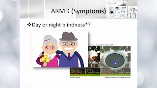 Elbromboly Basic ophthalmology IC Retina Retinal dystrophies and degeneration