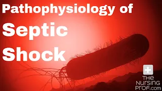 Pathophysiology of Septic Shock