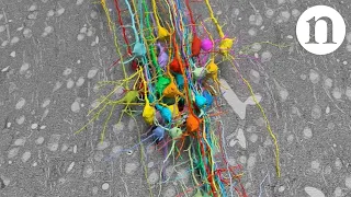 Neuroscience: Crammed with connections