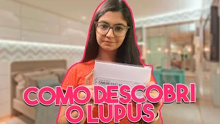 MEU DIAGNÓSTICO DE LÚPUS